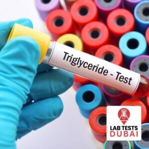Triglycerides Serum Test