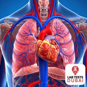 Troponin I Quantitative Test