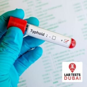Typhi Dot IgM