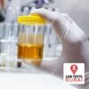 Urea (24 Hour Urine) Test