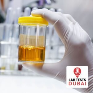 Urea (24 Hour Urine) Test