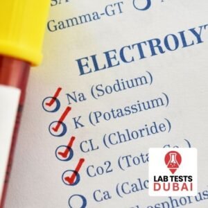 Urea Lab Test Electrolytes (NaKCl)