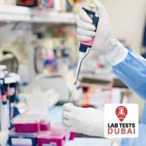 Urine Immunofixation Test (Immuno Electrophoresis)