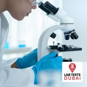 Vanillyl Mandelic Acid (VMA) 24-Hour Urine Test