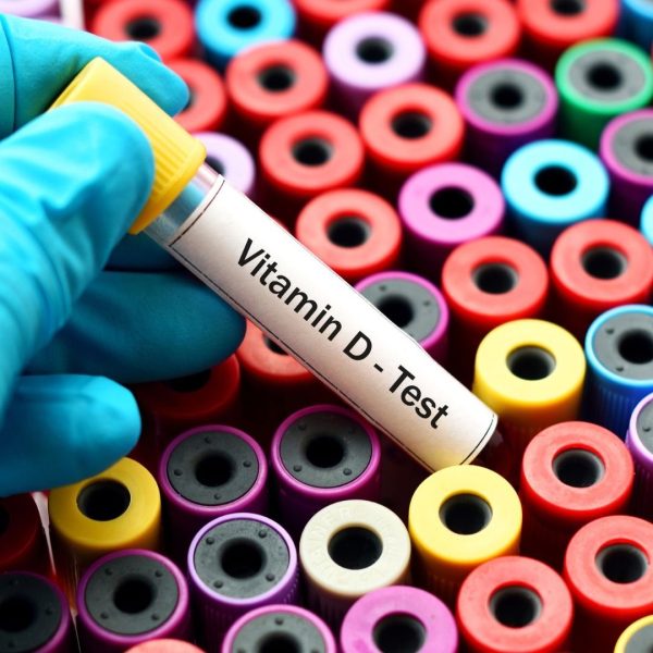 25-OH Vitamin D Test