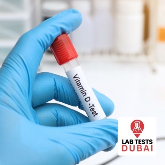 Vitamin D Total Serum Test – Enzyme-Immunoassay for Bone & Immune Health 1 Vitamin D Total Serum Test