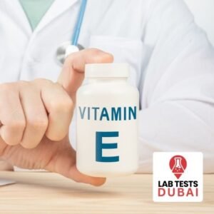 Vitamin E (Tocopherol) Serum Test