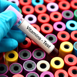 Vitamin Profile Test
