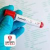 Widal Test for Typhoid Detection