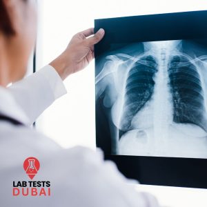 X-Ray Three-View Imaging