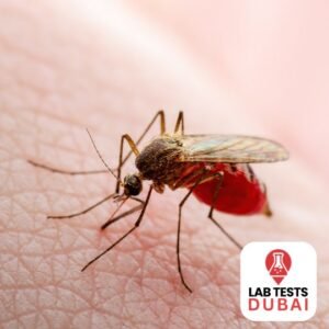 Zika Virus IgG & IgM Test