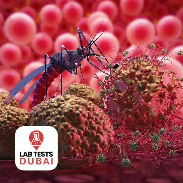 Zika Virus Test