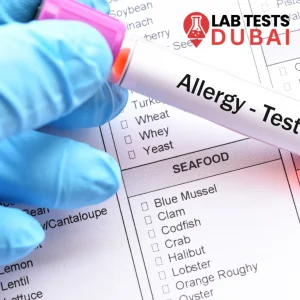 comprehensive allergy test dubai