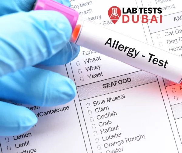 comprehensive allergy test dubai