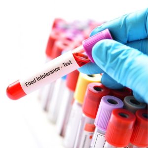 Food Intolerance Test