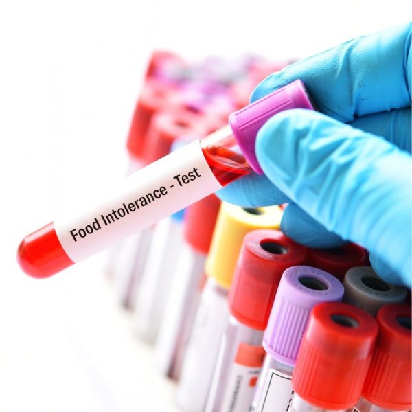 Food Intolerance Test