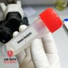 Semen Analysis Test – Accurate Male Semen Testing & Sperm Health Check