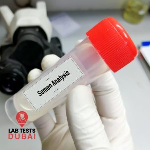 Semen Analysis Test – Accurate Male Semen Testing & Sperm Health Check