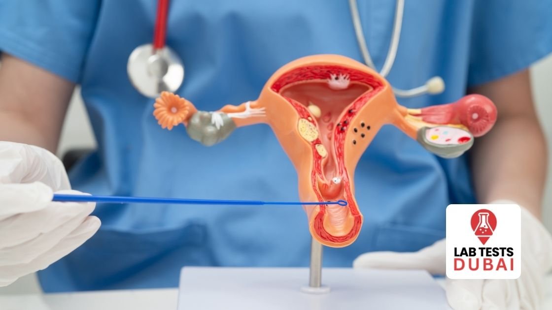 Understanding the High Vaginal Swab (HVS) Test 1 High Vaginal Swab (HVS) Culture & Sensitivity Test